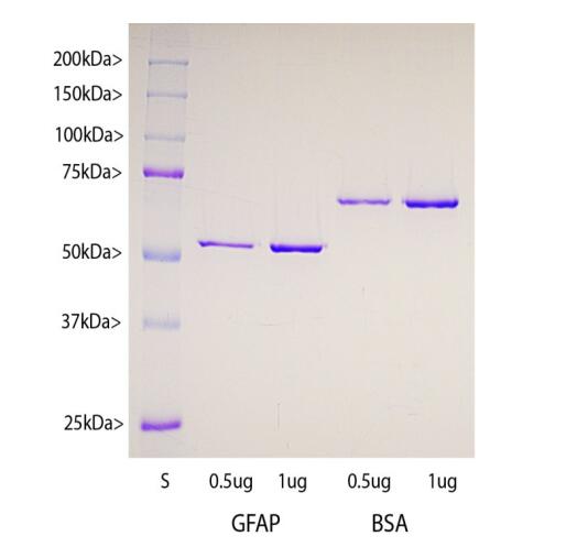 0.5 and 1 μg of recombinant GFAP based on the human isotype I sequence was expressed in and purified from E. coli using standard methods and run out for SDS-PAGE in lanes on the left as indicated. The two rightmost lanes show 0.5 and 1 μg of BSA protein standard. Lane S shows protein standards of the indicated molecular weights, gel was stained with Coomassie brilliant blue protein stain.